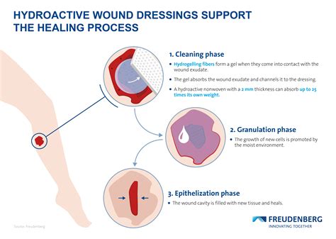 Aggregate More Than 109 Wound Dressing Procedure Super Hot Vn