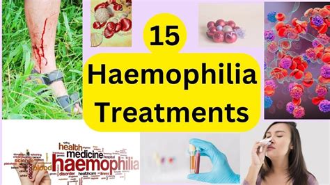 15 Haemophilia Treatments Hemophilia A Hemophilia B And Hemophilia