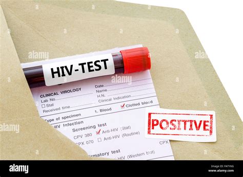 Blood Sample With Hiv Test Positive And Request Laboratory Form On