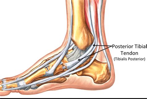 Posterior Tibial Tendon Dysfunction The Movement Centre