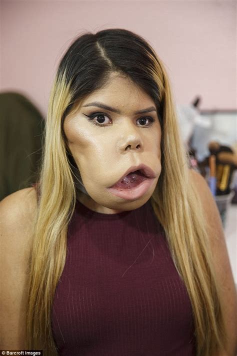 Marimar Quiroa Born With Facial Tumour Is A Youtube Star With Her Beauty Tutorials Daily Mail