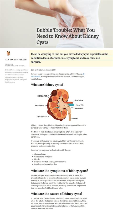 What You Need To Know About Kidney Cysts Advanced Urology