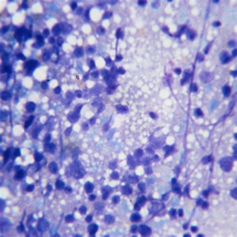 Here i explore what exosomes are, highlight the difficulties in studying them and explain the current definition and some of. What Are the Functions of Microfilaments & Microtubules ...