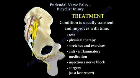 Pudendal Nerve Palsy Bicyclist Injury Everything You Need To Know