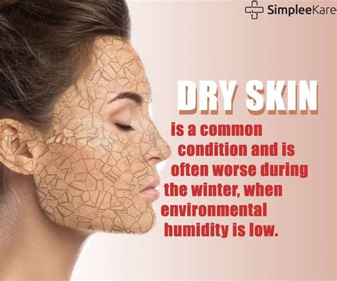 Dry Skin Is An Uncomfortable Condition Marked By Scaling Itching And