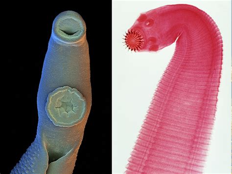 Why Im Fascinated By Parasitic Worms Ncpr News
