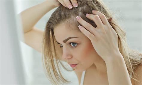 Women And Hair Loss Alamo City Dermatology Dermatologists