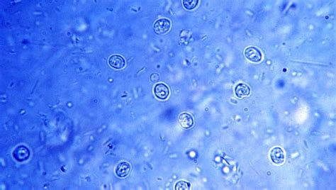 Cryptosporidiosis in humans is caused by protozoa. Cryptosporidium In Dogs: Symptoms, Causes, & Treatments ...
