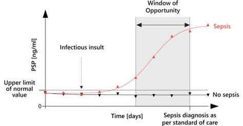 What Is Sepsis Abionic