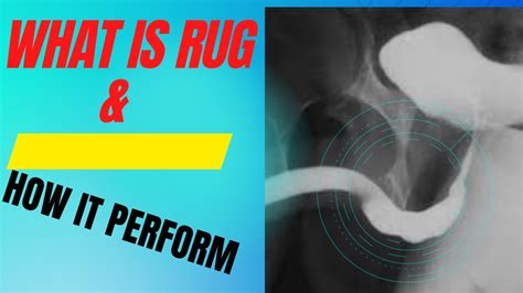 What Is R U G Retrograde Urethrogram X Ray Procedure R U G Test In