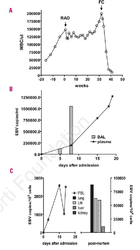 Pdf Fatal Epstein Barr Virus Associated Lymphoproliferative Disorder