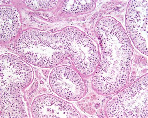 Filetestis Histology 010 Embryology