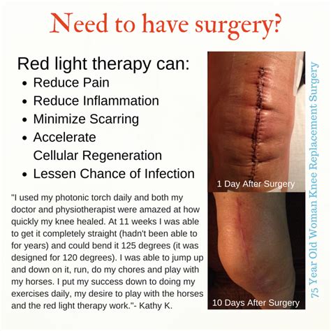 Red Light Therapy Applied To 10 Day Old Knee Replacement Surgical Scar Before And After