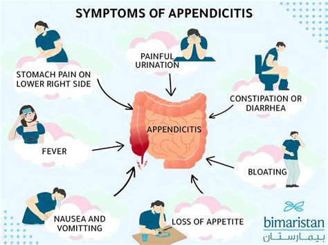 Simple Appendicitis Symptoms And Treatment Bimaristan