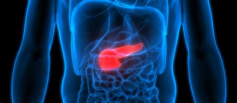 Rak Trzustki Opis Przyczyny Objawy Leczenie Dolekarzy Pl