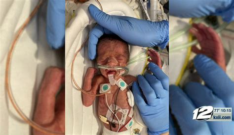 Premature Baby Born 11 Weeks Early Heads Home From Hospital Walking