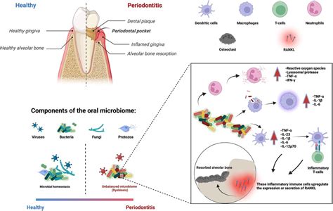 Frontiers Innovative Biomaterials For The Treatment Of Periodontal Disease