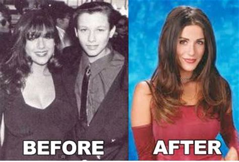 Celebrity Soleil Moon Frye Plastic Surgery Before After
