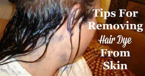 How To Remove Hair Color From Your Skin ~ Rdmdesignllc