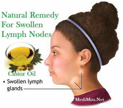 Castor Oil Natural Remedy For Swollen Lymph Nodes Swollen Lymph