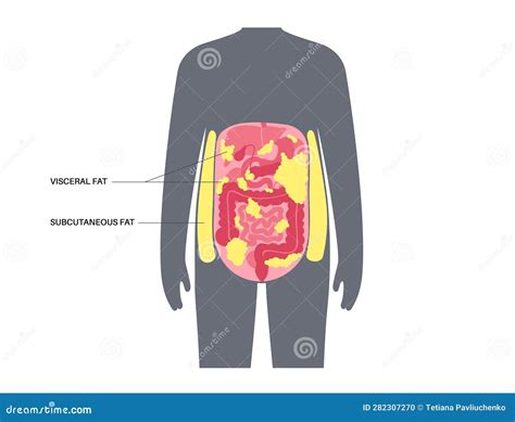 Visceral Fat Diagram Cartoon Vector 282613723