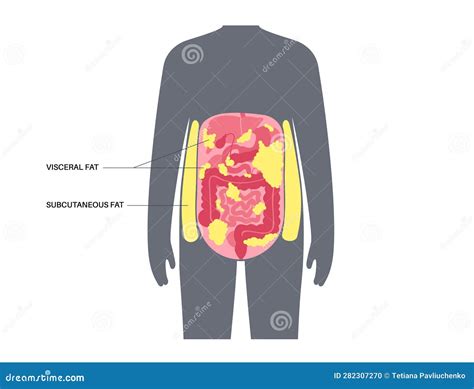 Visceral Fat Diagram Stock Vector Illustration Of Structure 282307270