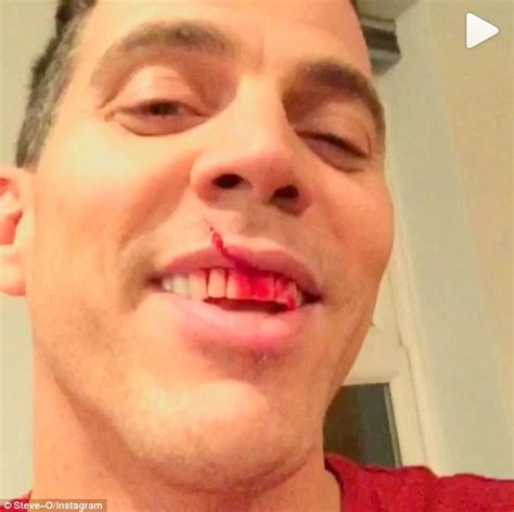 Steve O Gets Hit In The Face By A Falling Knife Daily Mail Online