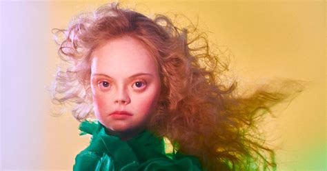Radical Beauty Project Downs Syndrome