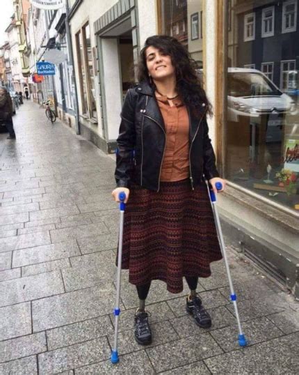 Dak Amputee Girl With Protheses On Crutches Fashion Women Girl