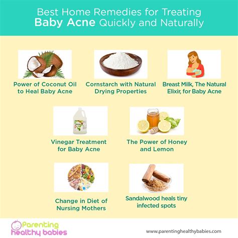 Ultimate Guide For Treating Baby Acne Naturally Home Remedies