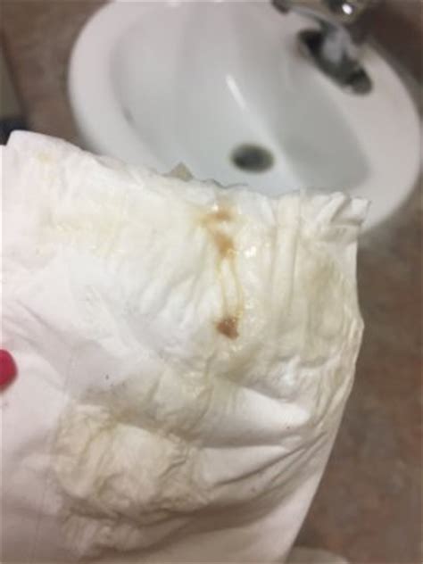 During pregnancy, your cervix becomes blocked by a mucus plug, which will come out as you near delivery. TMI ***PICTURE*** Brown mucus discharge - October 2017 ...