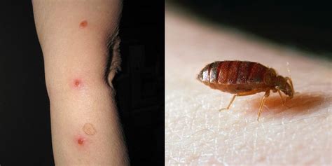 You Can Have Bed Bugs And Not Know It—heres What To Look Out For Bed