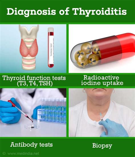 Thyroiditis Types Causes Symptoms Diagnosis Treatment