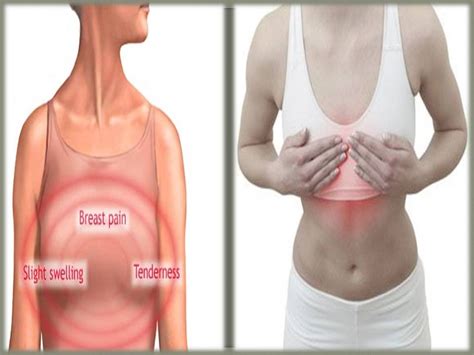 Easy Way To Alleviate Breast Tenderness YouTube