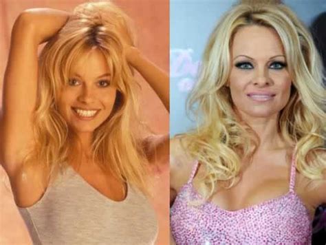 The Most Expensive Celebrity Plastic Surgeries Ever And How Much They