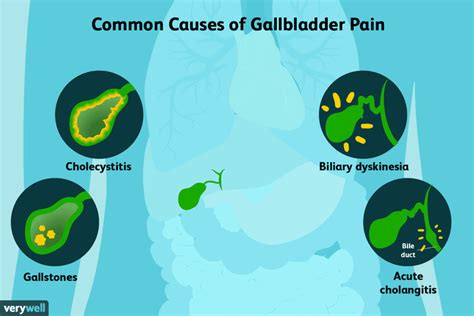 Gallbladder Pain Causes Treatment And When To See A Doctor