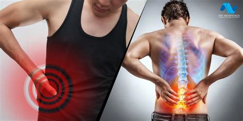 How To Differentiate Between Kidney Pain And Back Pain By Nu Hospitals
