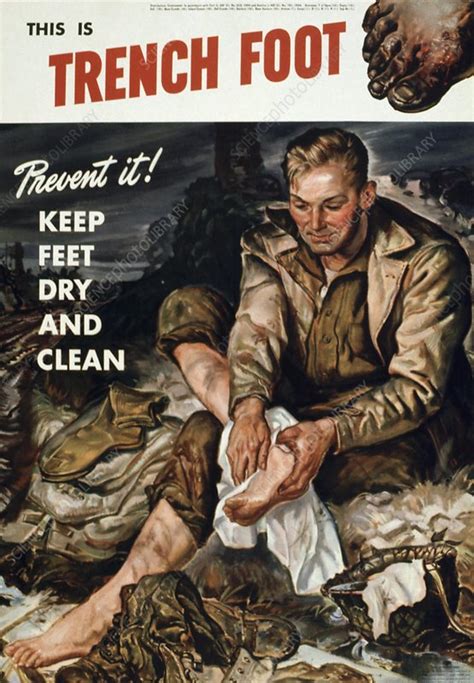 Trench Foot Poster World War Ii Stock Image C0102671 Science