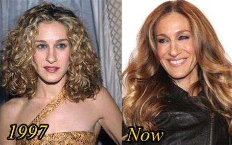 Sarah Jessica Parker Plastic Surgery Before And After Plastic Surgery