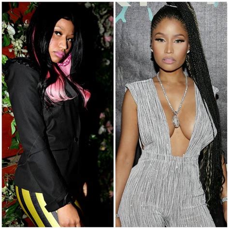 Nicki Minajs Before And After Plastic Surgery Photos Look Extremely