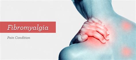 Healthiculture What Exactly Is Fibromyalgia