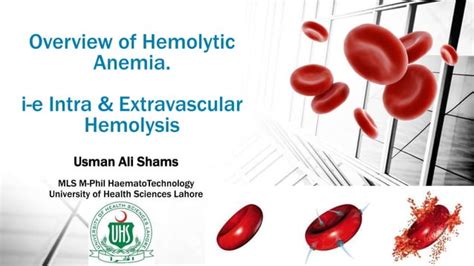 Hemolytic Anemia Guide Intravascular Vs Extravascular Hemolysis Ppt