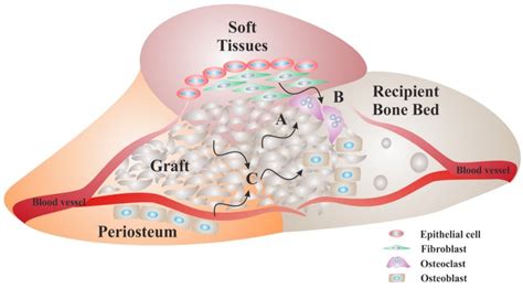 Materials Free Full Text Bone Replacement Materials And Techniques