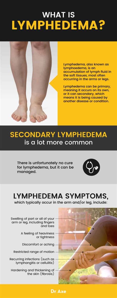 Lymphedema 7 Natural Ways To Manage Symptoms Dr Axe Lymphedema