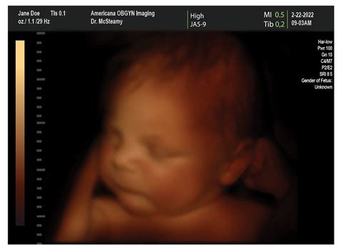 4d and 2d fake ultrasound generator free sonograms