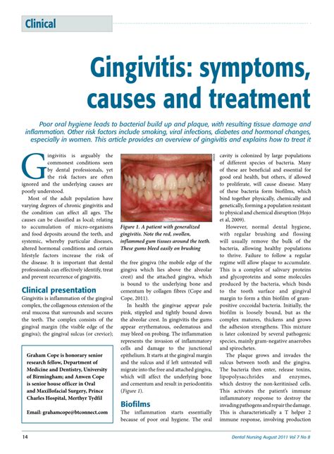 Pdf Gingivitis Symptoms Causes And Treatment