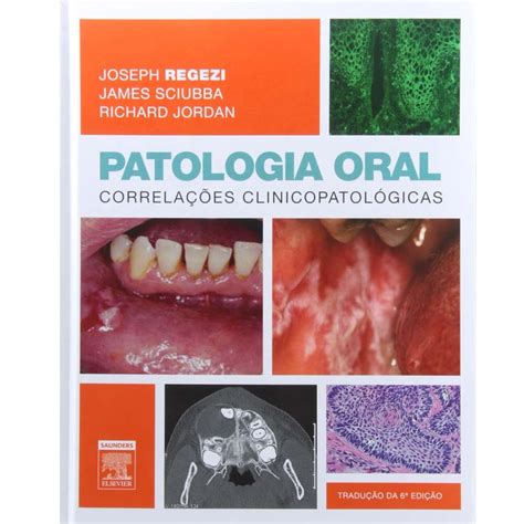 livro patologia oral correlações clinicopatológicas 6ª edição 2013 joseph a regezi