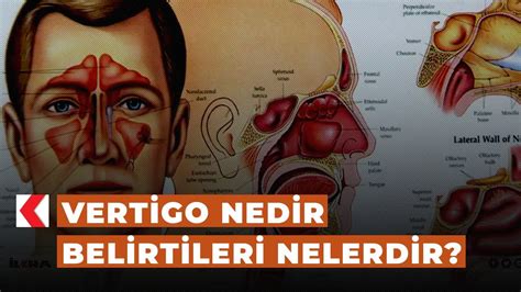 Vertigo Nedir Belirtileri Nelerdir YouTube