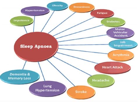 Sleep Apnea Treatment Brea Ca Snoring Treatment Fullerton