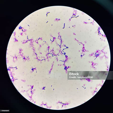 Gram Positive Cocci In Chain Stock Photo Download Image Now